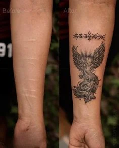 SCAR COVER-UP example 2