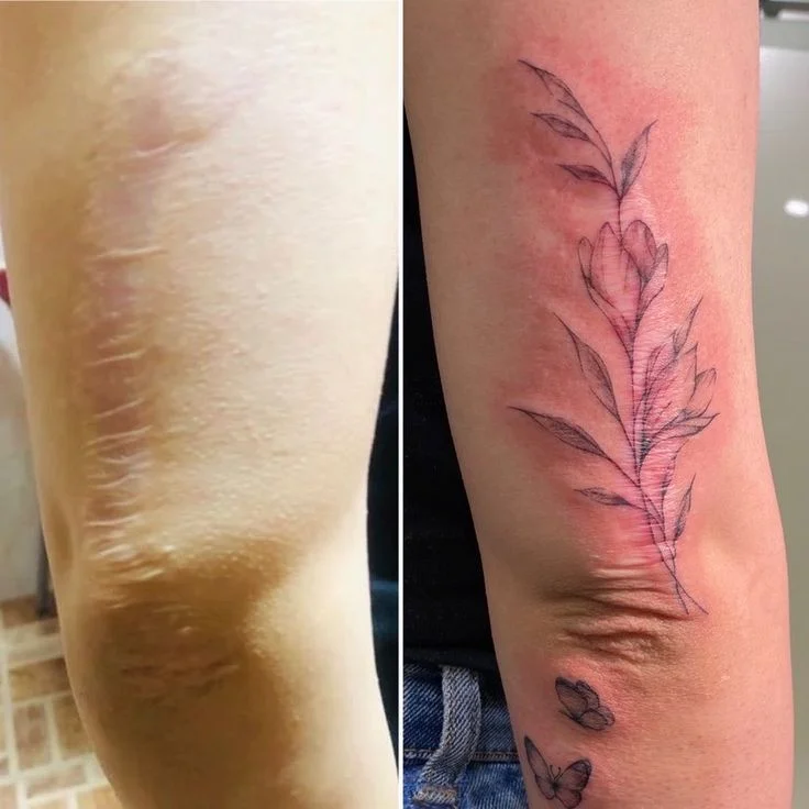 SCAR COVER-UP example 4
